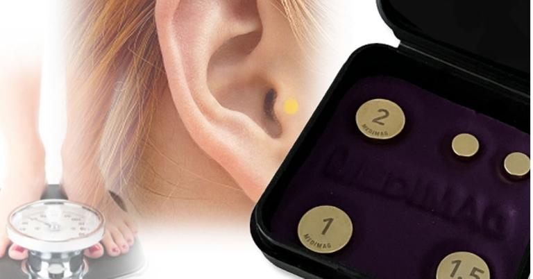 Akupunkturmagnete zur Gewichtskontrolle